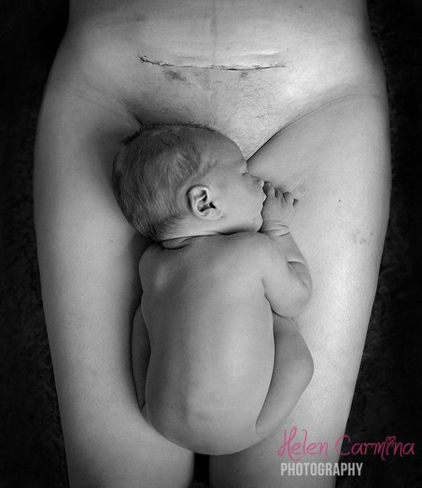 HelenCarminaPhotography-c-section-BC-1